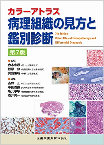 WebOPAC Local書誌詳細