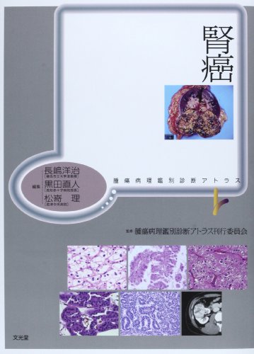 腎盂・尿管・膀胱癌/文光堂/都築豊徳（単行本） 腎盂・尿管・膀胱癌 第2版(腫瘍病理鑑別診断アトラス) | 宮居